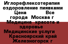 Иглорефлексотерапия, оздоровление пиявками › Цена ­ 3 000 - Все города, Москва г. Медицина, красота и здоровье » Медицинские услуги   . Красноярский край,Железногорск г.